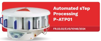 Automated sTep Processing